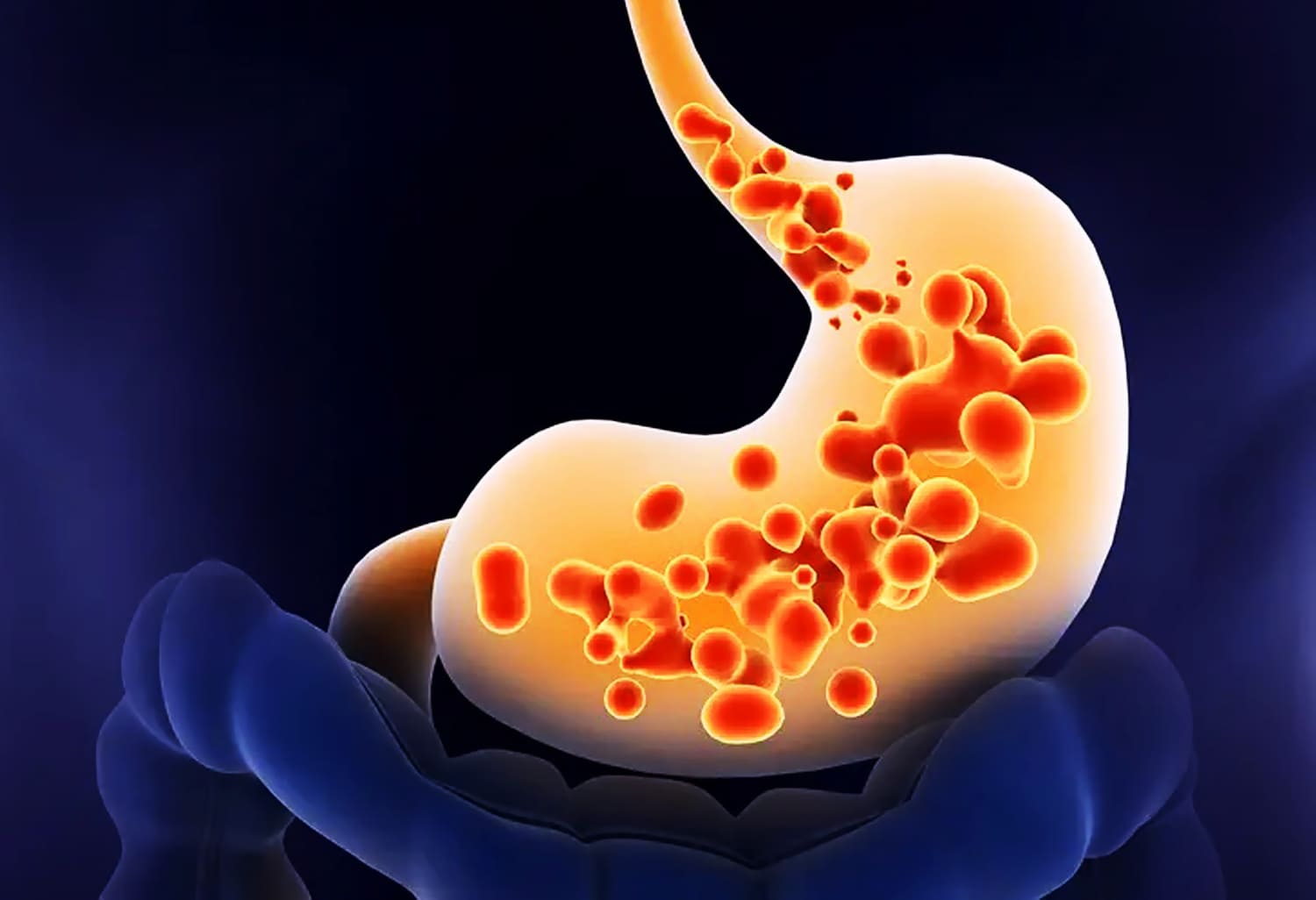 Bekam Batam Pengobatan Efektif Untuk Maag dan Gerd