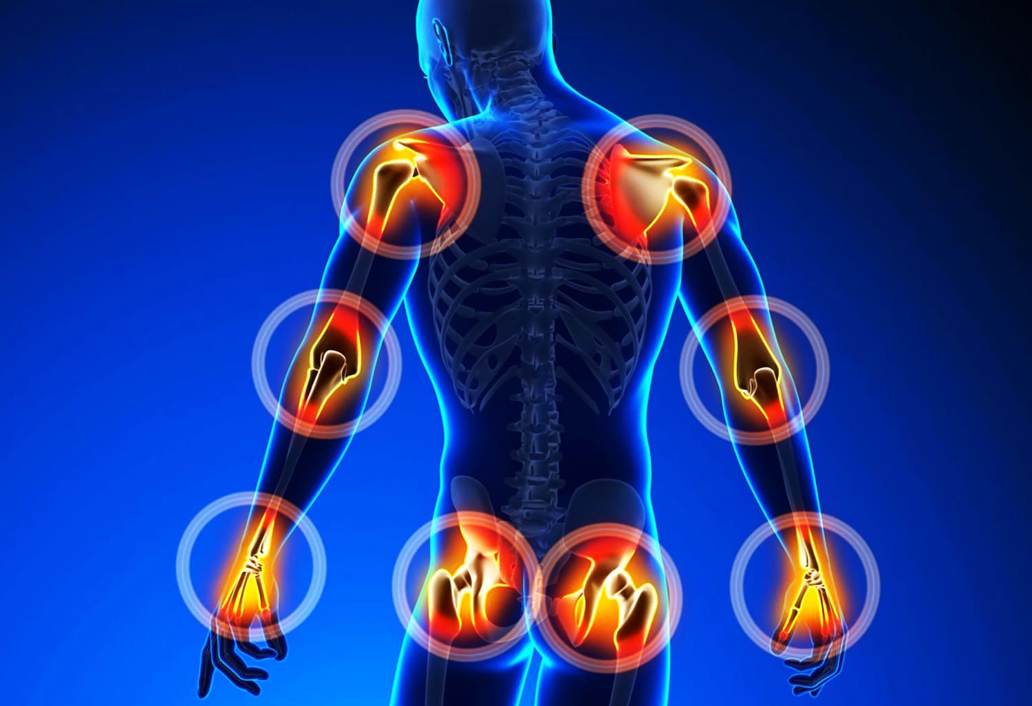 Bekam Untuk Nyeri, Begini Penjelasan Ilmiahnya